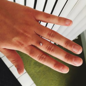 Dermal piercing on finger